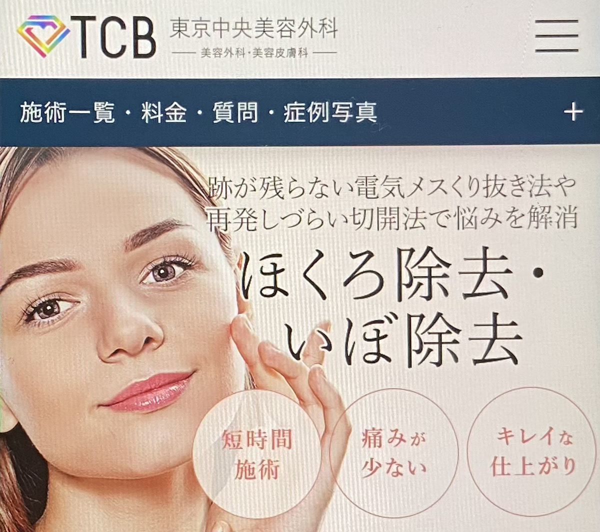 【駅前院・大通院】くり抜き法によるほくろ除去が受けられるTCB東京中央美容外科