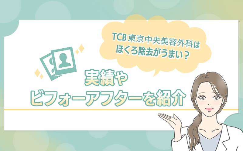 TCB東京中央美容外科はほくろ除去がうまい？実績やビフォーアフターを紹介