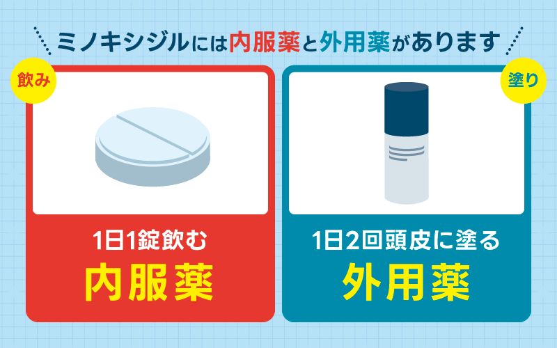 ミノキシジル 種類